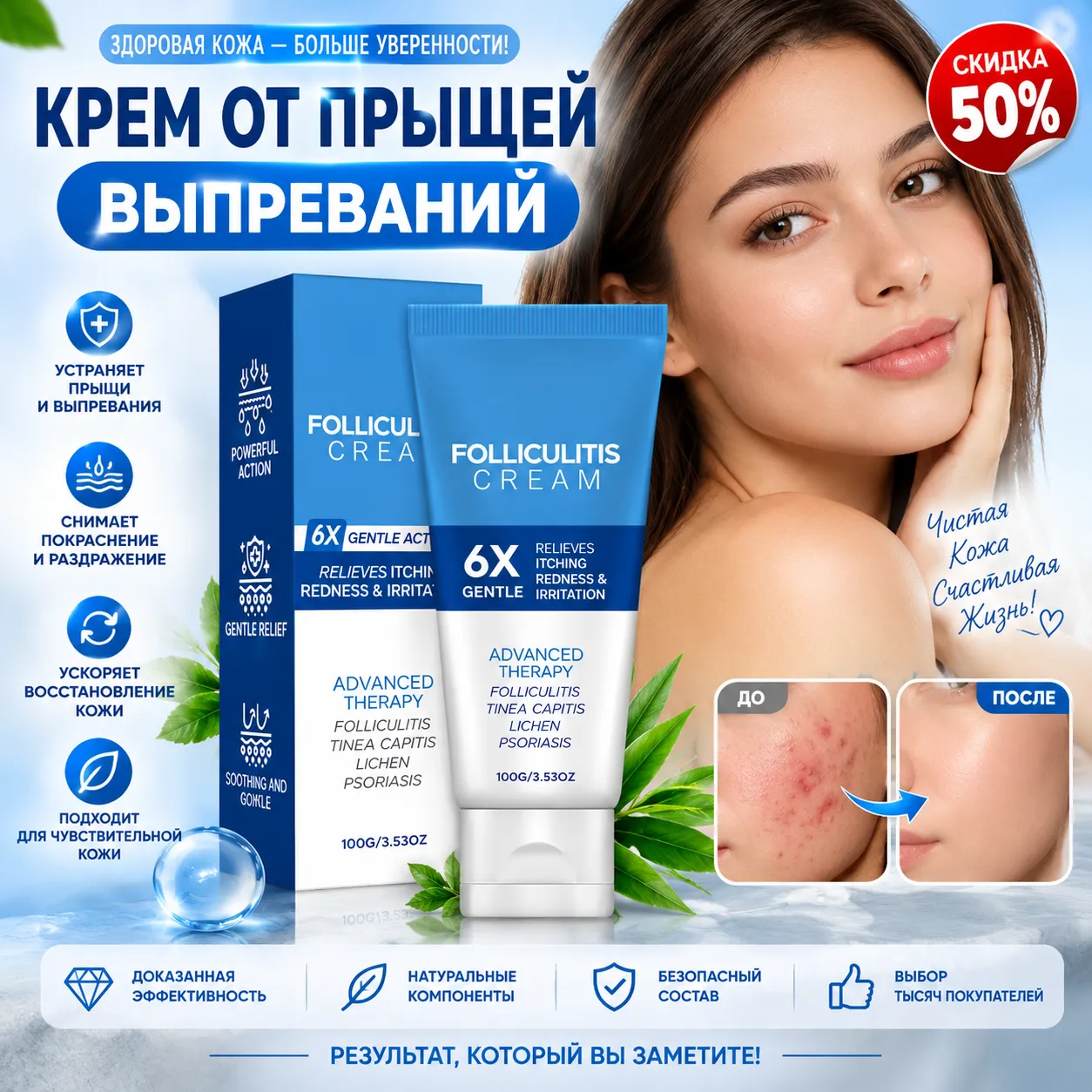 Крем от прыщей и выпреваний, скидка 50%